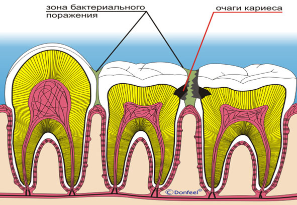 О пользе зубных нитей
